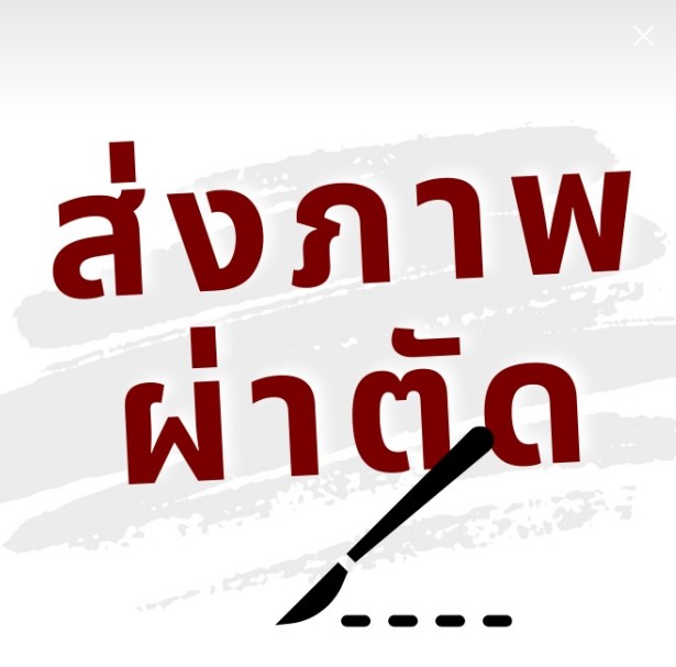 ส่งภาพผ่าตัด
